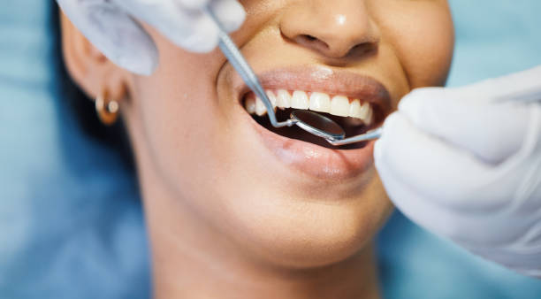 Best Emergency Dental Services for Seniors in Marietta, OH