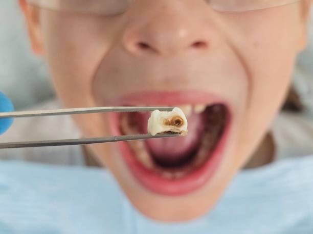 Best Pediatric Emergency Dentist in Marietta, OH