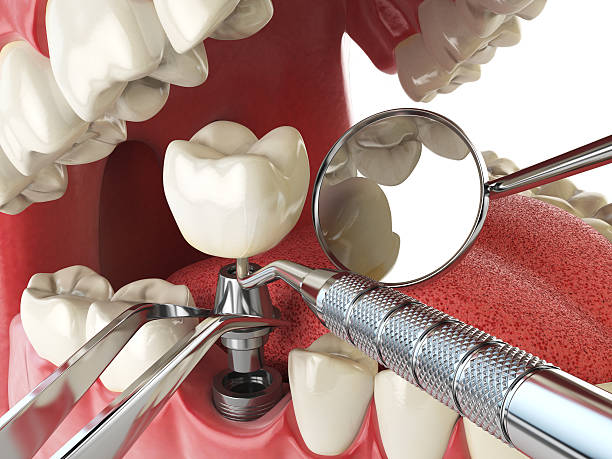 Best Emergency Dentist for Special Needs Patients in Marietta, OH